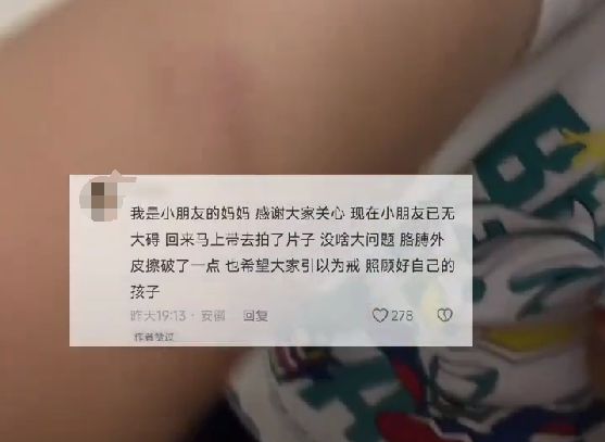 揪心！男童手卡机场扶梯嚎啕大哭(图2)