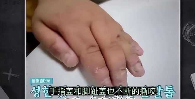 韩国母亲执意生下“超雄综合症”儿子长大后行为吓到全家人(图3)