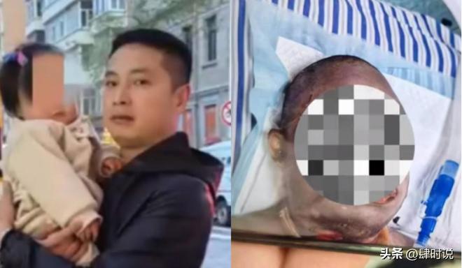 凯发国际燃气爆炸男子烧伤后续：房东忽视整改通知原因曝光与老鼠有关(图2)