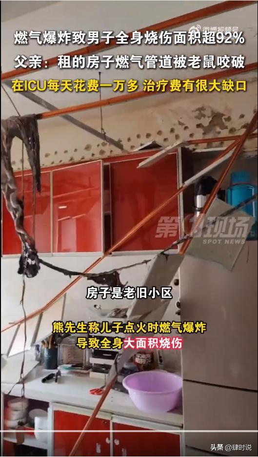 凯发国际燃气爆炸男子烧伤后续：房东忽视整改通知原因曝光与老鼠有关(图14)