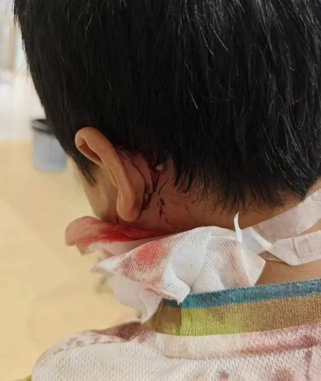 车衣被狗啃到面目全非女车主再发声:是二手车但是我的第一辆车没买车损险(图2)