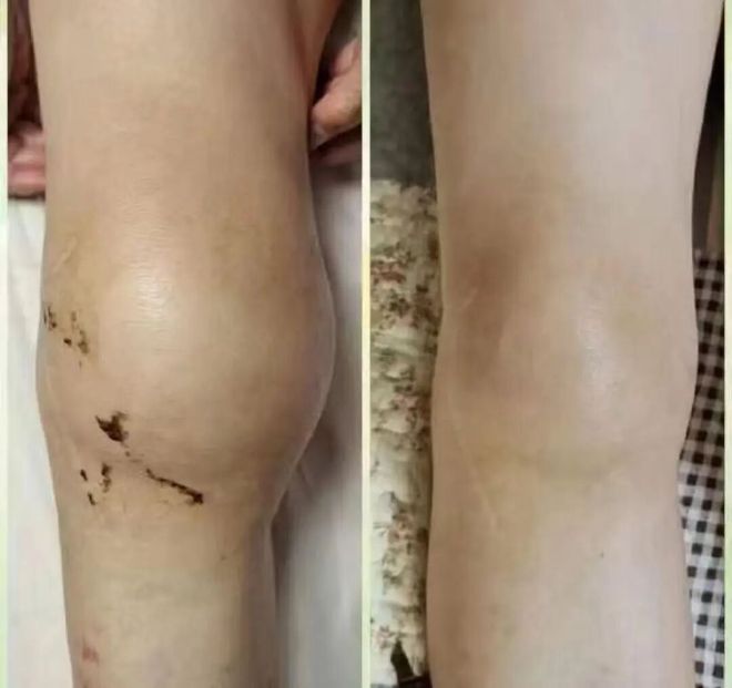 上了年纪的女人小心“老寒腿”今年流行这么穿个个保暖又时髦(图4)