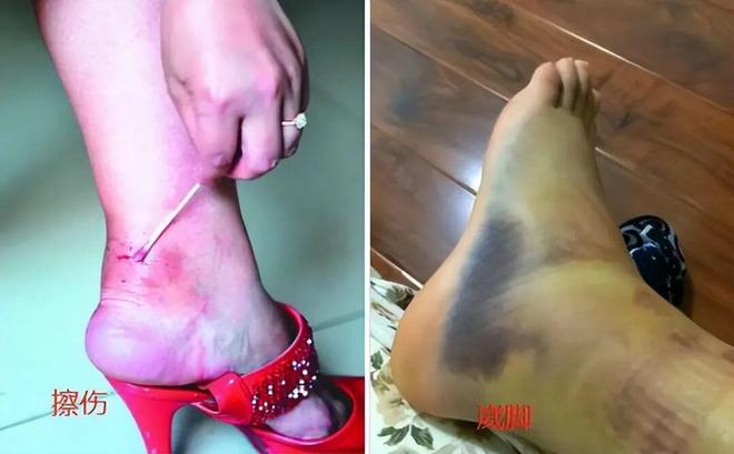 上了年纪的女人小心“老寒腿”今年流行这么穿个个保暖又时髦(图10)